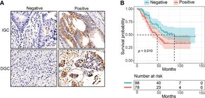 Positive Phospho-Focal Adhesion Kinase in Gastric Cancer Associates With Poor Prognosis After Curative Resection